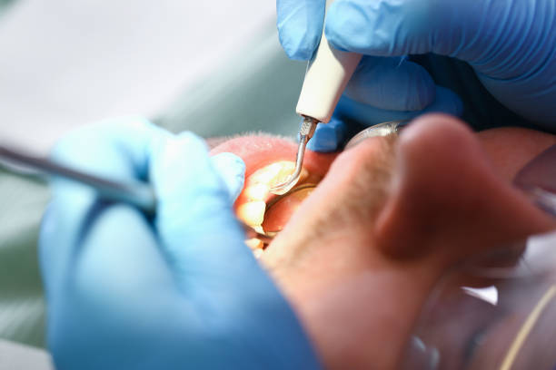 Best Emergency Cosmetic Dentistry (e.g., broken veneers) in Clayton, MO
